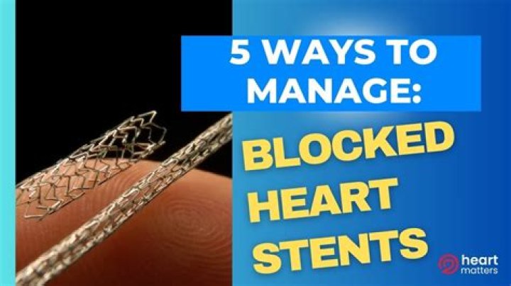 How much blockage requires a stent?