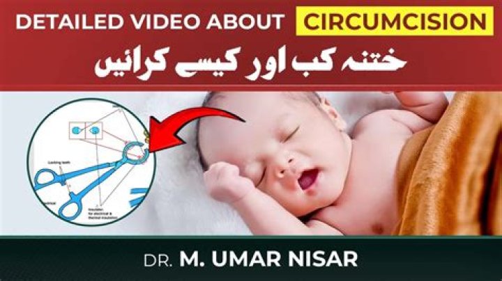 How much do circumcisions cost for a newborn?