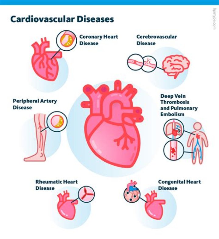 How much does a cardiovascular tech make an hour?