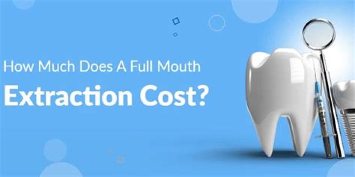 How much does a full facial reconstruction cost?