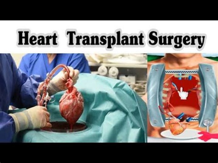 How much does a heart transplant surgeon make a year?
