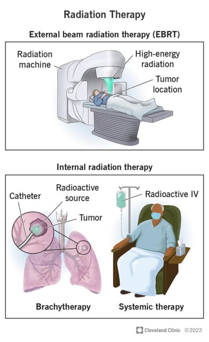 How much does a radiation technologist make?