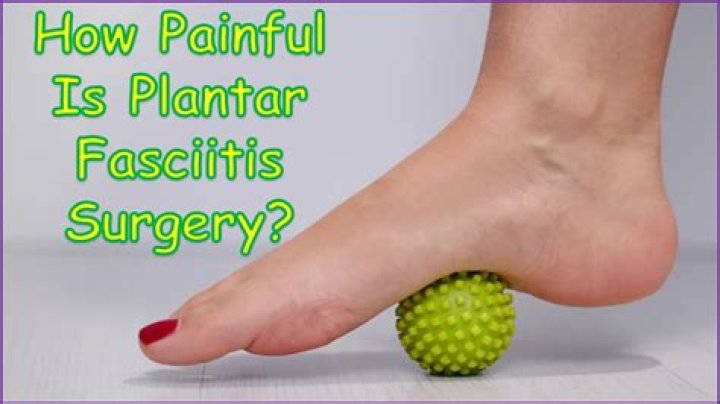How painful is plantar fasciitis?