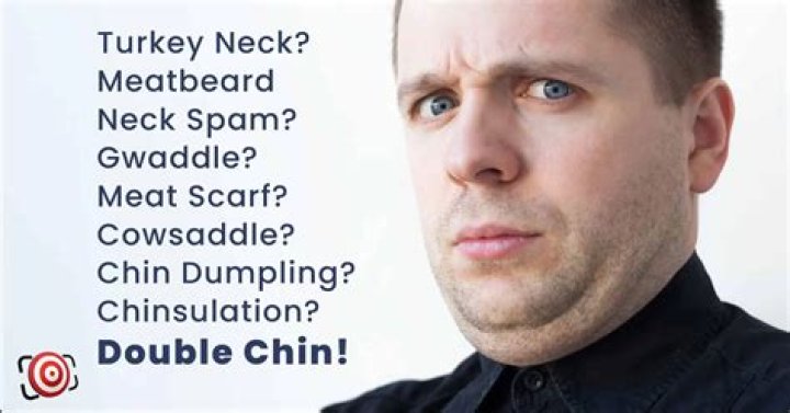 Is a double chin permanent?