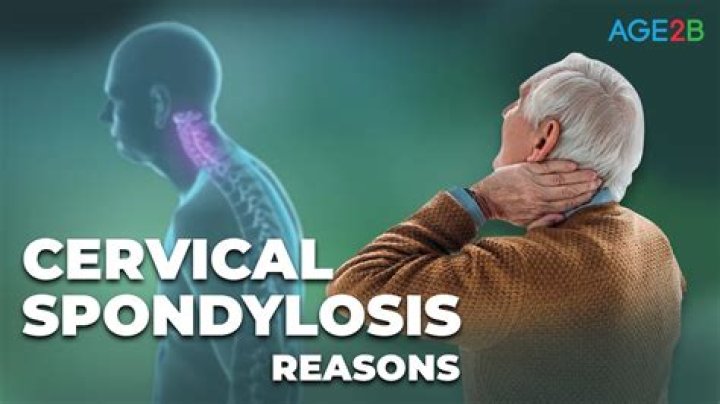 Is cervical spondylosis serious?