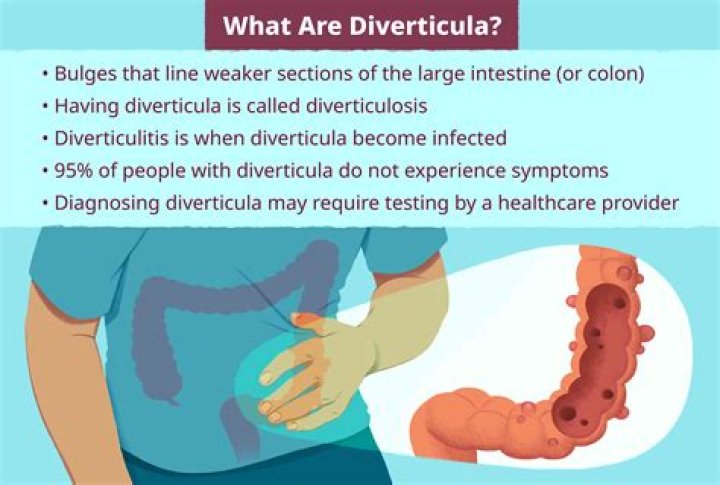 Is flatulence a symptom of diverticulosis?