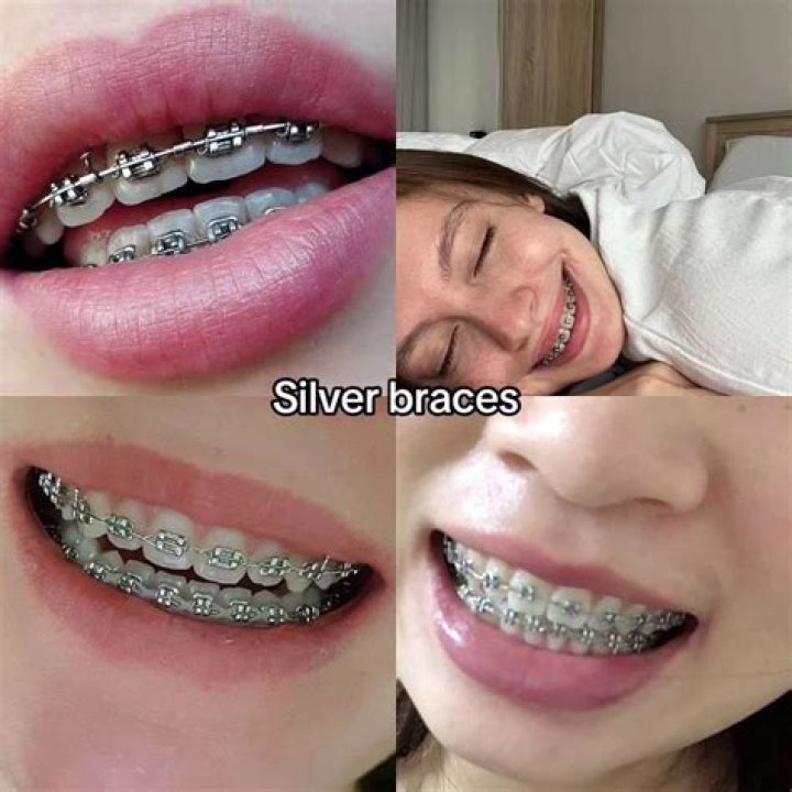 Is GREY a good color for braces?