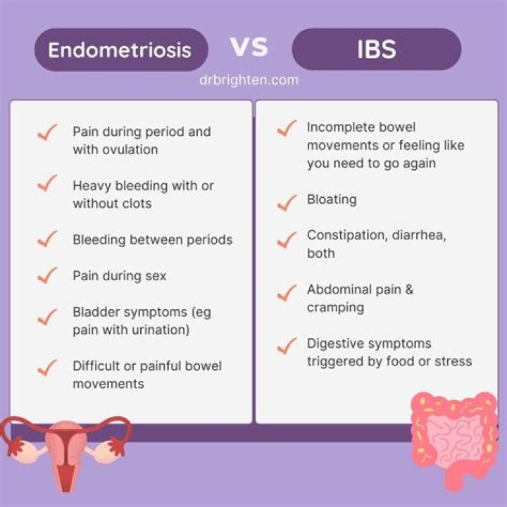 Is it IBS or endometriosis?