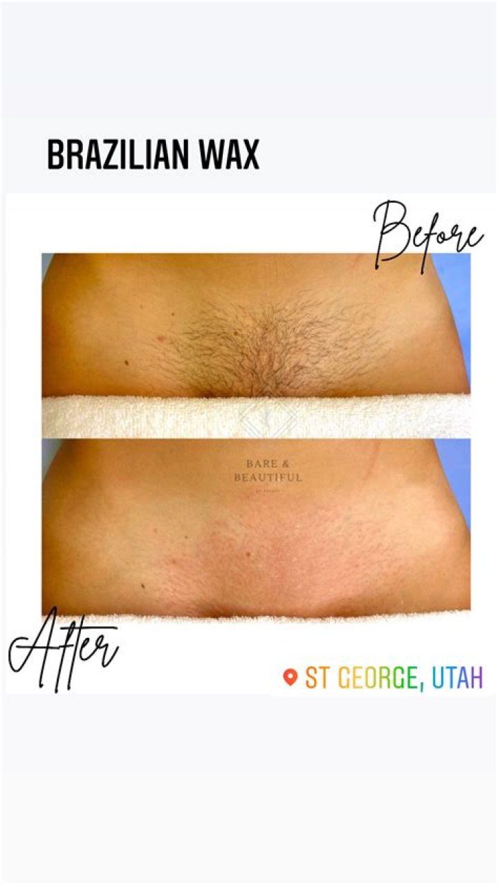 Is it weird to get a Brazilian wax?