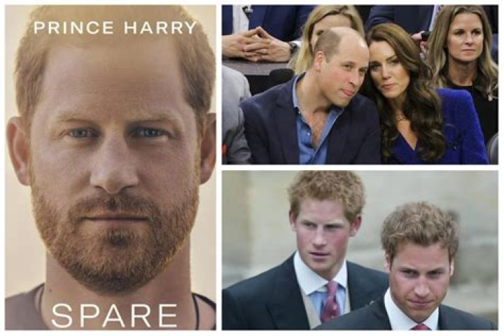 Is Prince Harry's hair thinning?