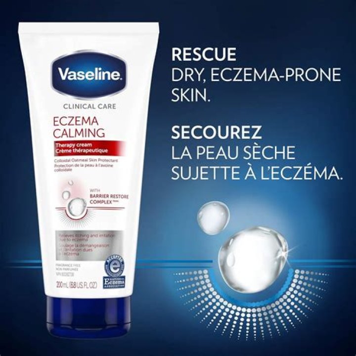Is Vaseline good for eczema?