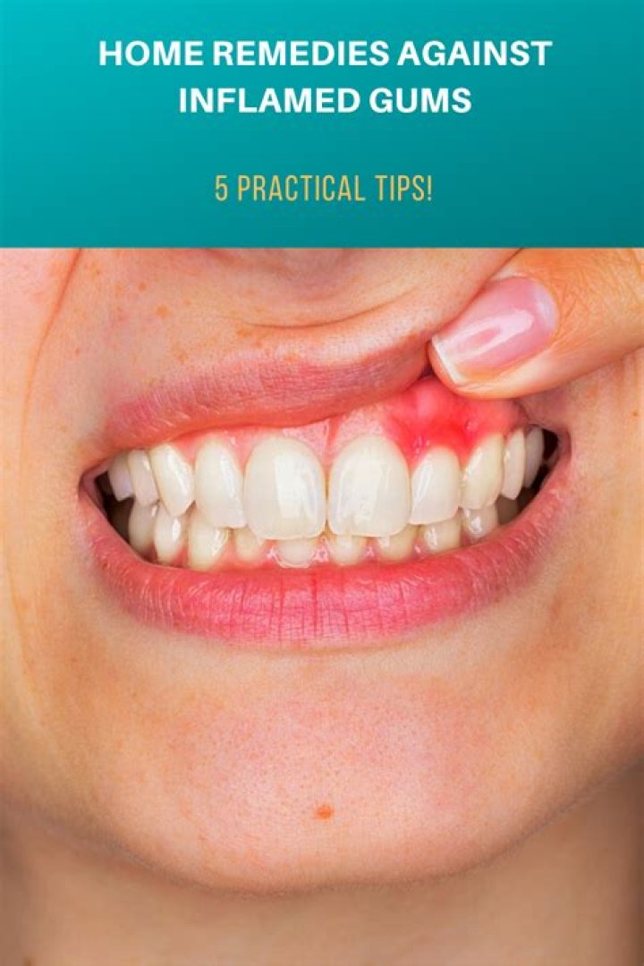 What are home remedies for inflamed gums?