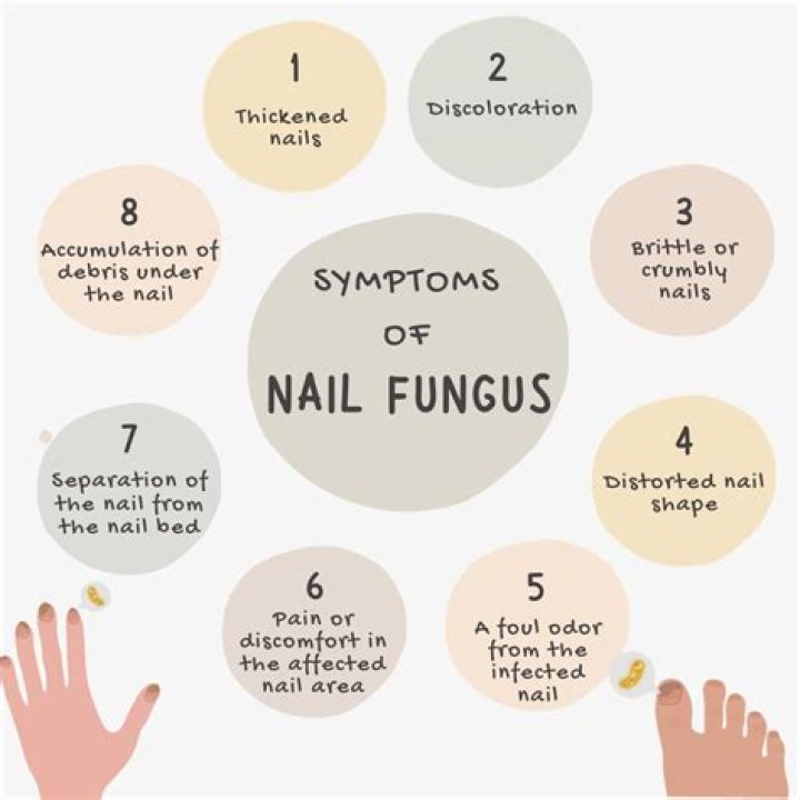 What are symptoms of fungus in the body?