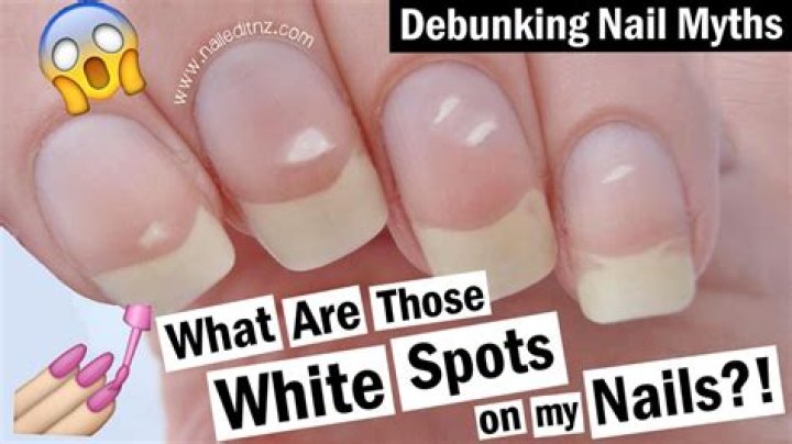 What are the white things on your nails?