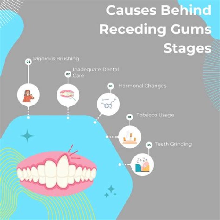 What causes gums to recede rapidly?