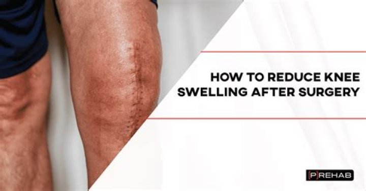 What causes swelling in leg after hip replacement?