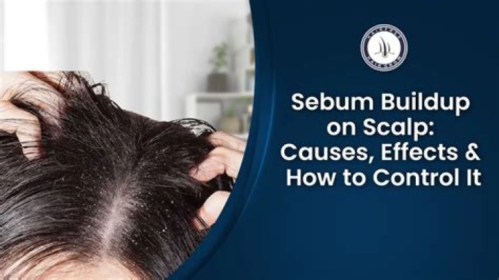 What causes yeast buildup on scalp?