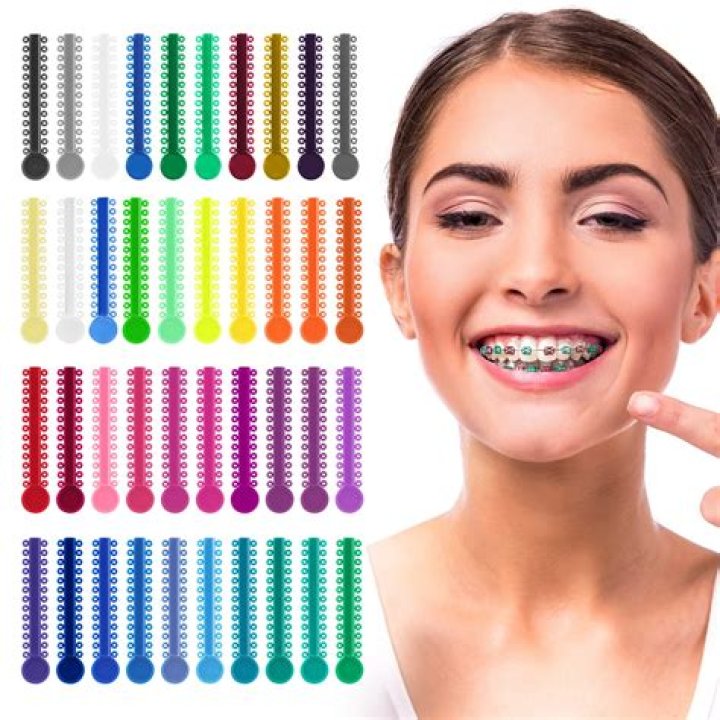 What color braces are most popular?