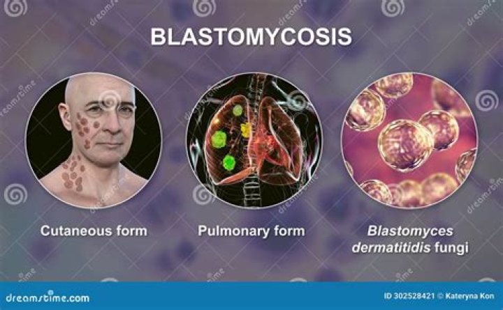 What color is blastomycosis?