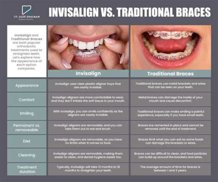 What disqualifies you from getting Invisalign?