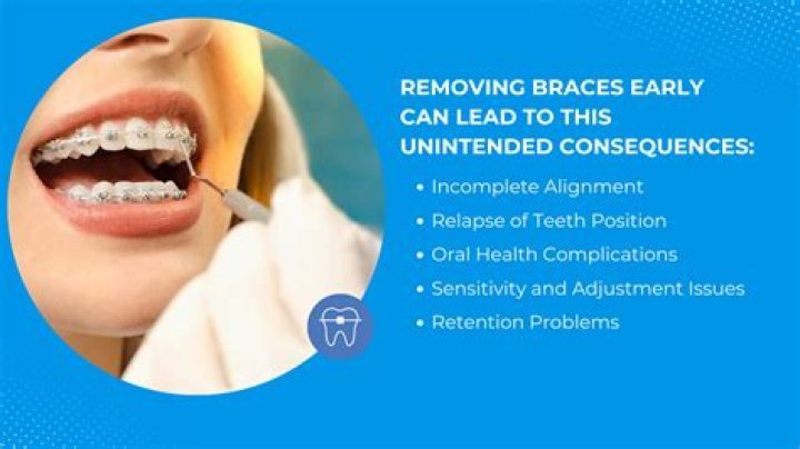 What do orthodontists do when taking braces off?