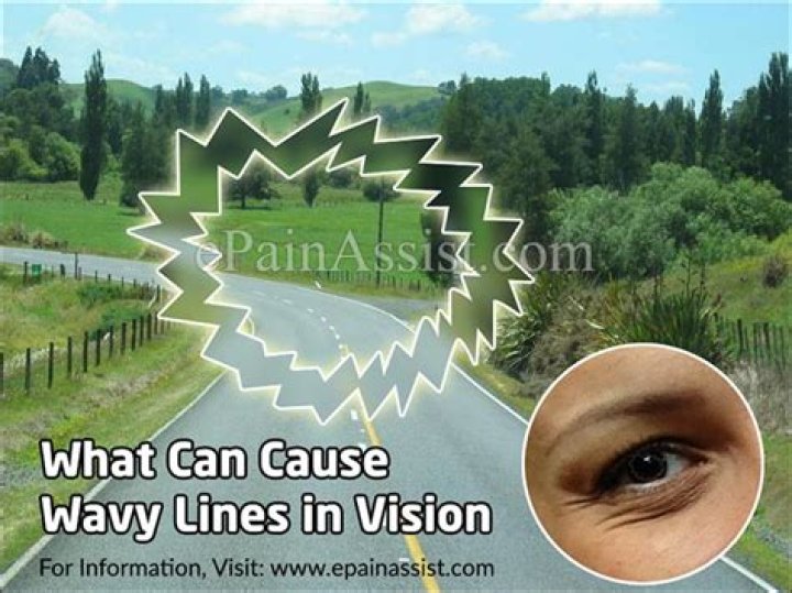 What do wavy lines in your vision mean?