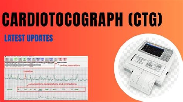 What does CTG stand for?