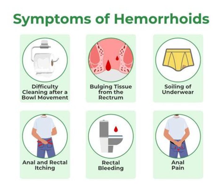 What does it mean when a hemorrhoid is hard?