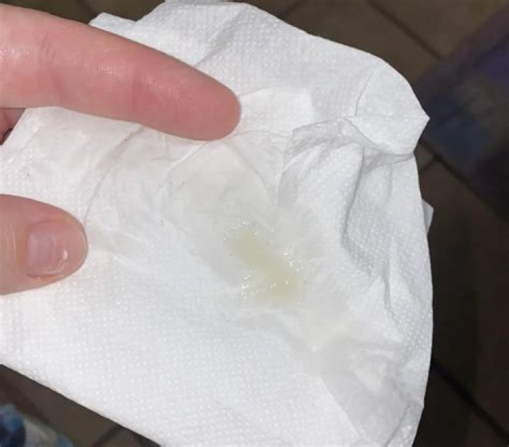 What does male discharge look like?