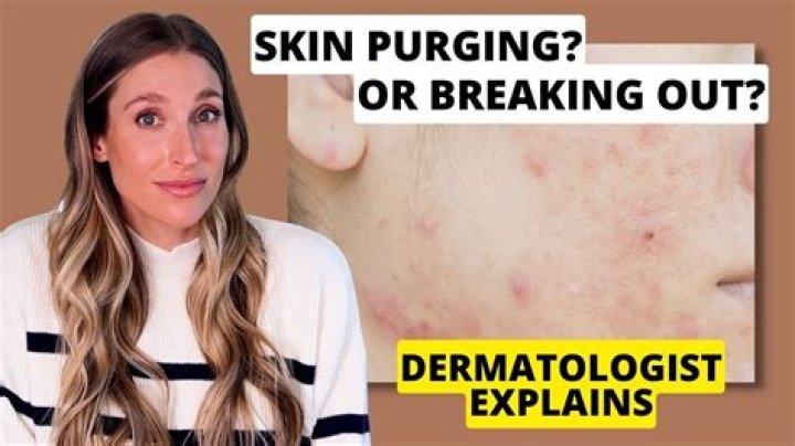 What does skin purging from retinol look like?