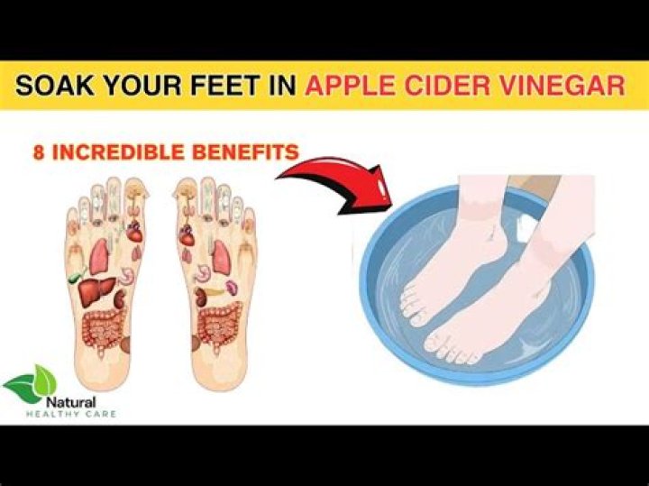 What does soaking feet in vinegar do?