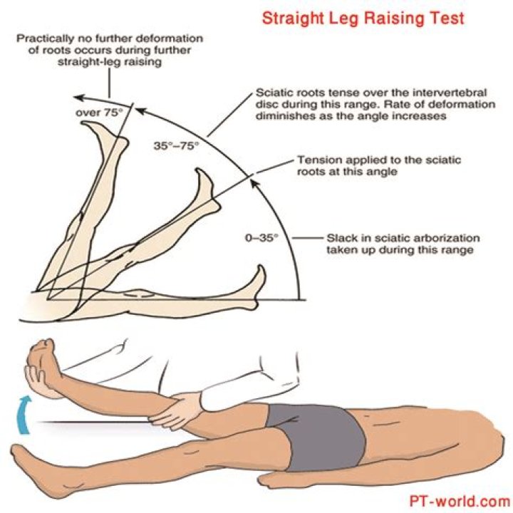 What does straight leg test for?