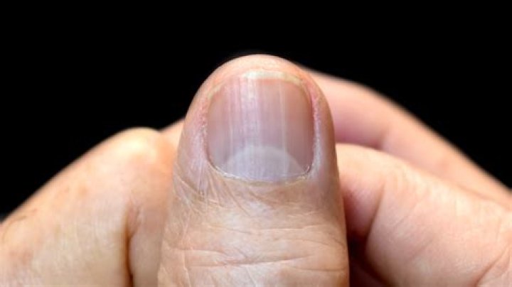 What does the white part of your nail bed mean?
