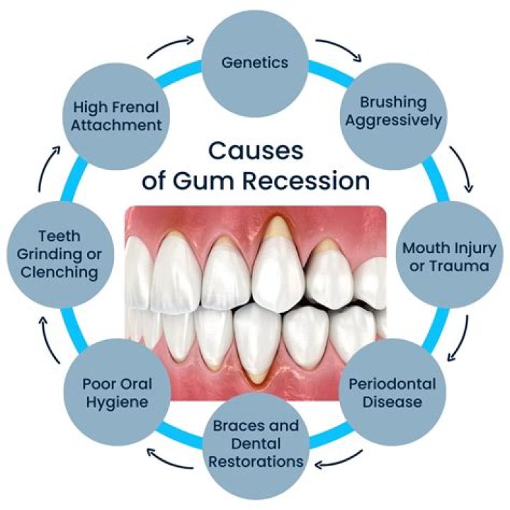 What foods help receding gums?