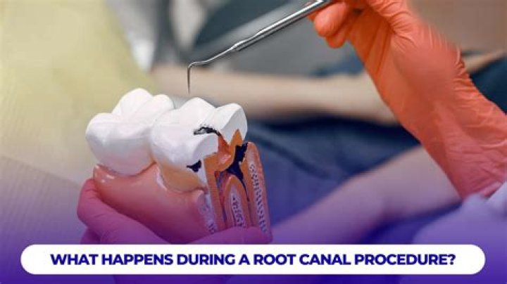 What happens during a VATS procedure?