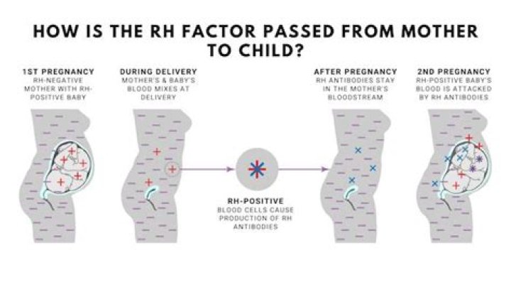 What happens if a mother is Rh negative and the baby is Rh positive?