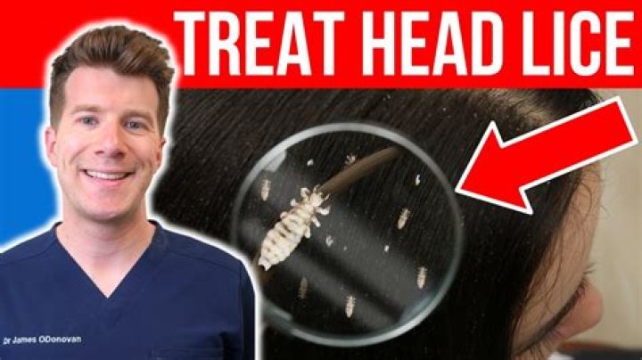 What happens if head lice is left untreated?