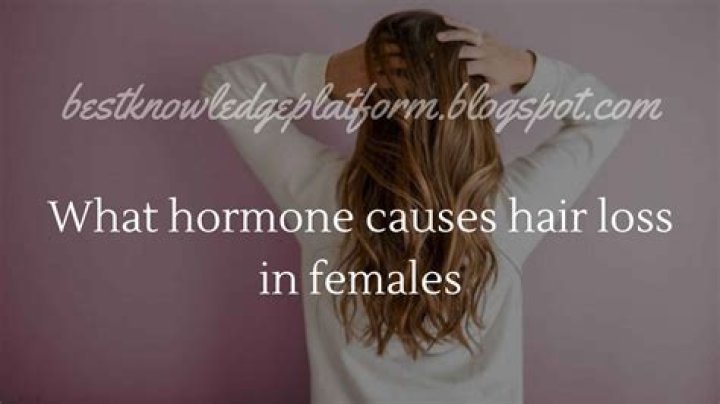 What hormone causes hair loss in females?