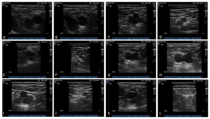 What is a deep ultrasound?