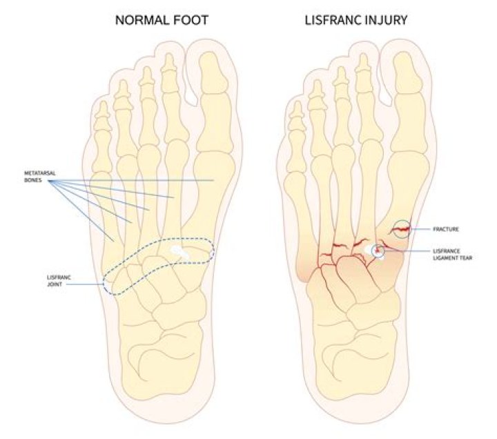 What is a foot injury worth?