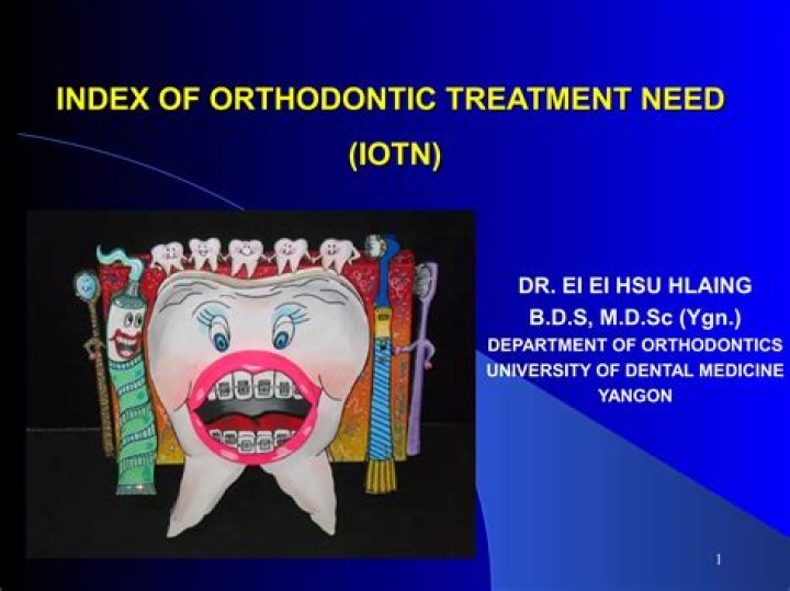 What is index of orthodontic treatment need?