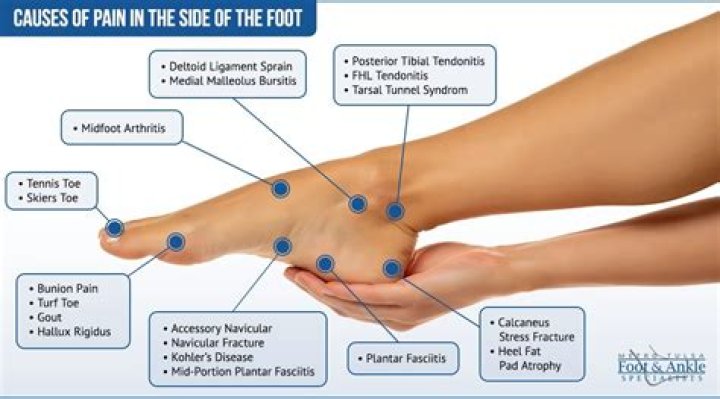 What is lupus foot pain like?