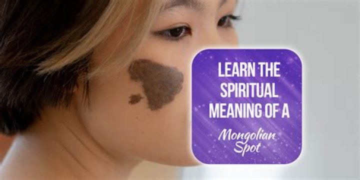 What is the Mongolian spot?