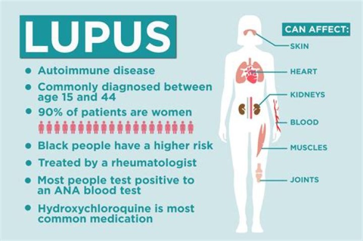 What is the most effective treatment for lupus?