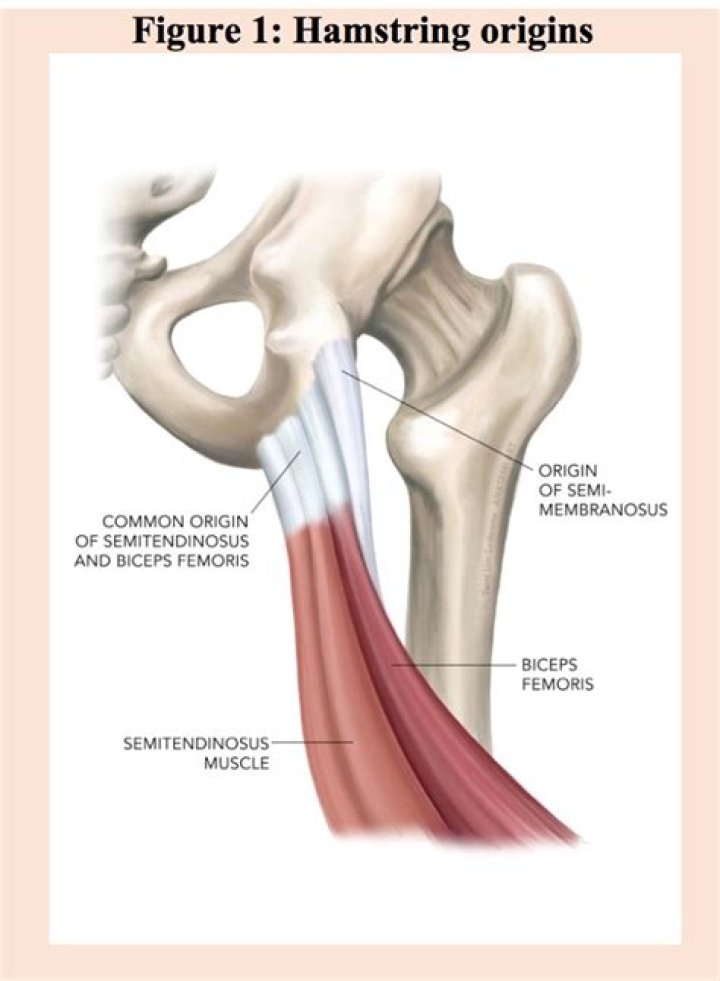 What is the most important thing to become an actress?