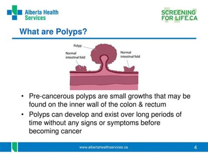 What percentage of large polyps are cancerous?