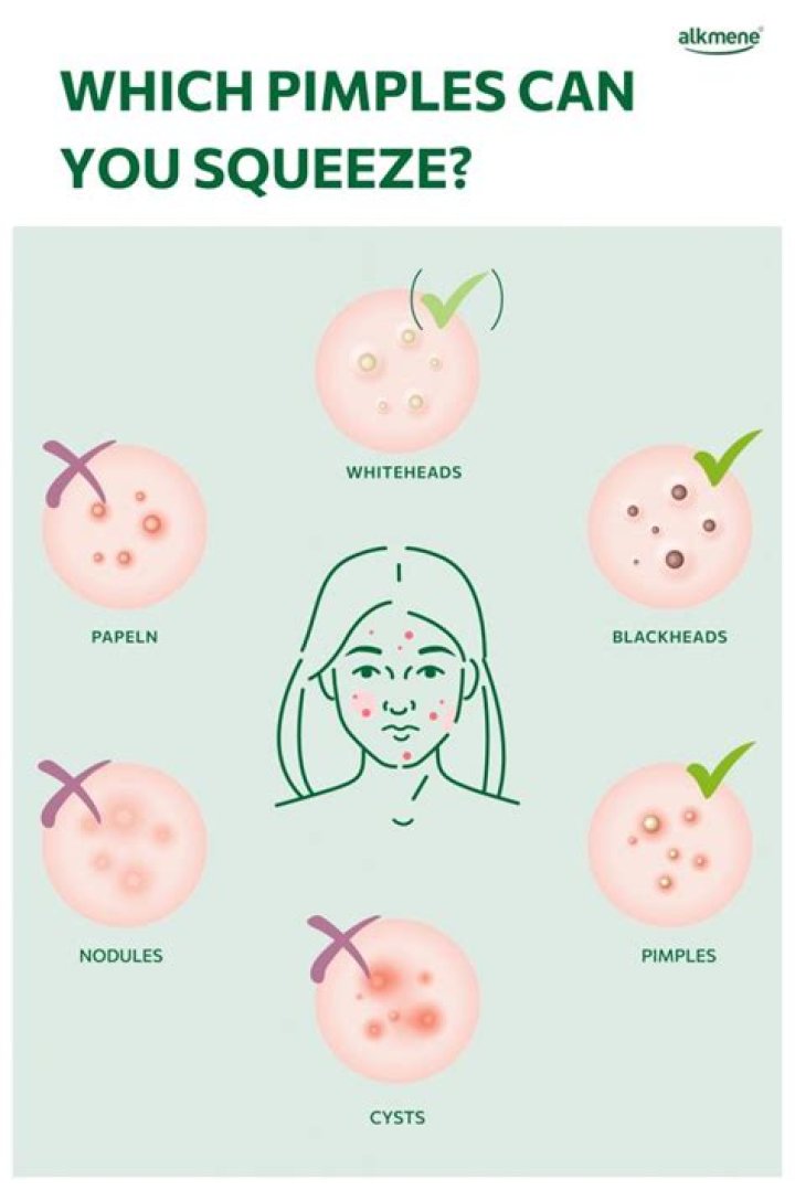 When I squeeze my pimple something hard comes out?