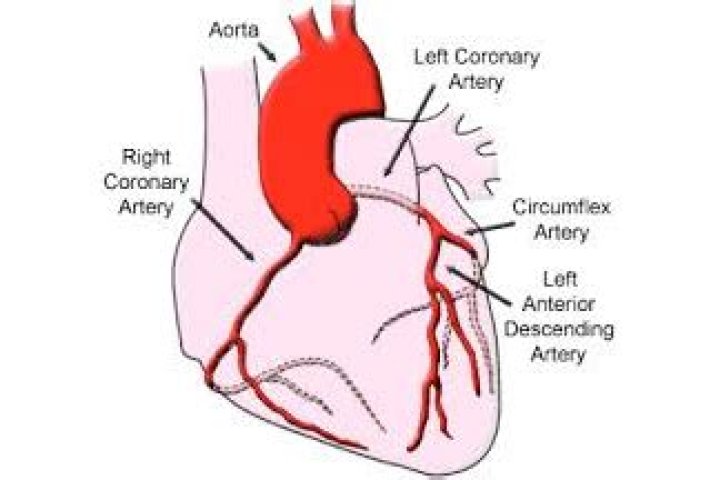 Which artery is the widow maker?