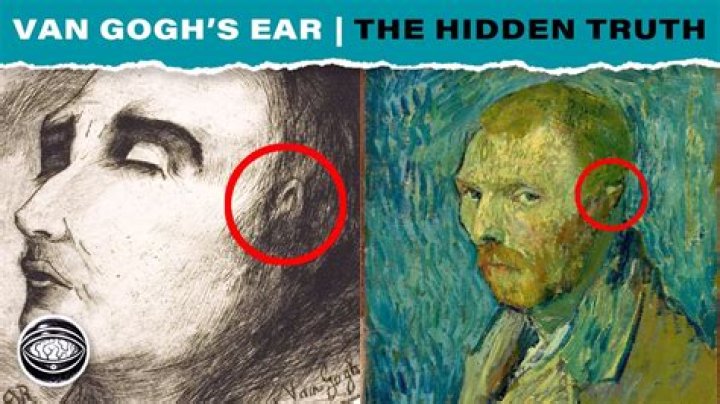 Who cut George's ear?
