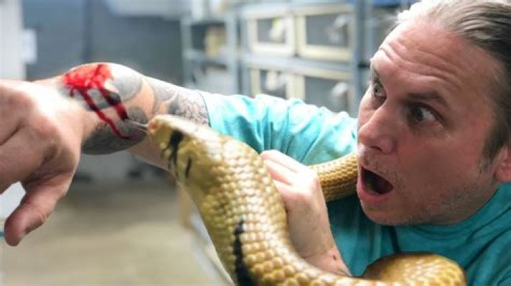 Who gets bit by snakes the most?